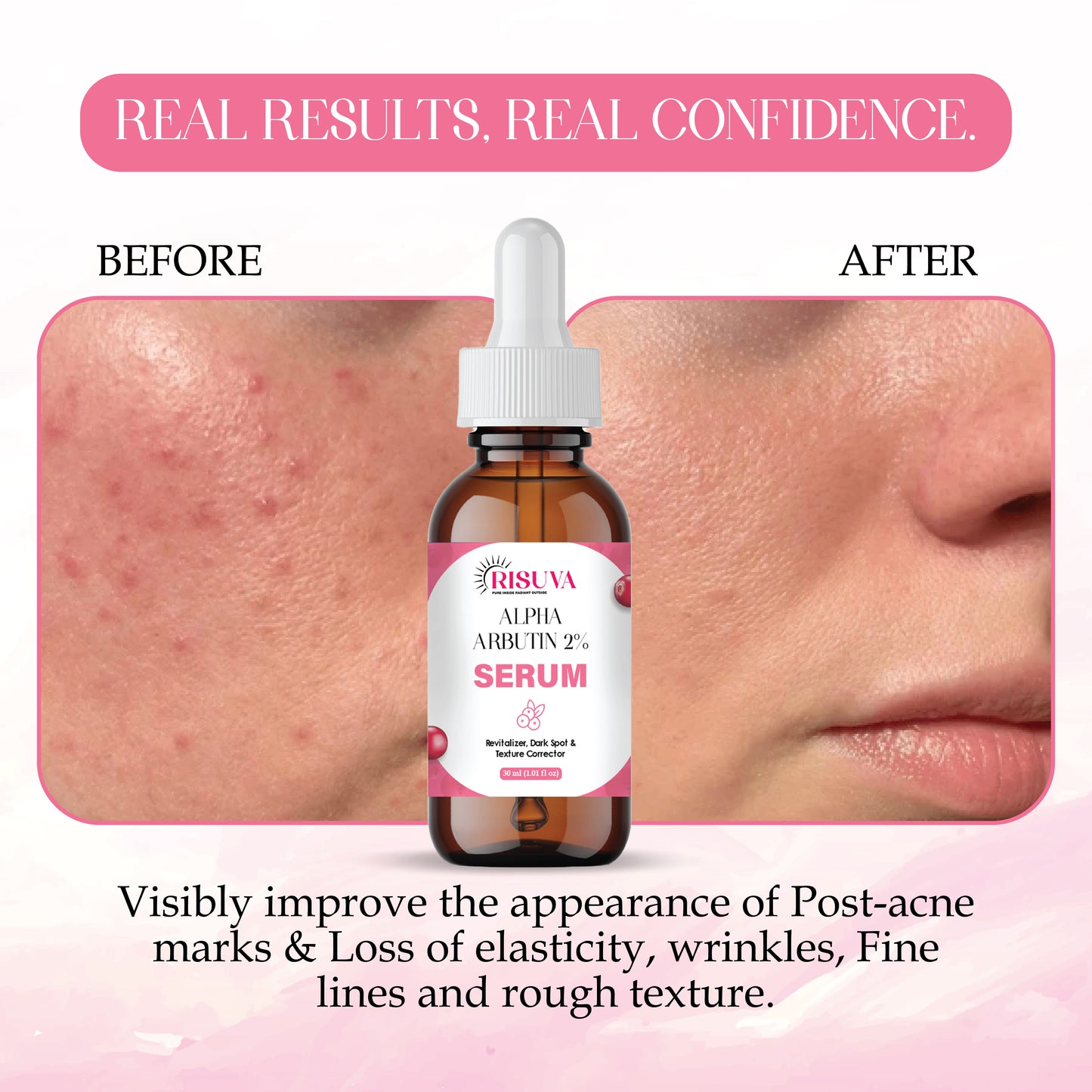 SilkSerum
